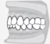 كيف يعمل VIP Aligner
